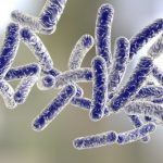 Outbreak of Legionnaires’ disease sickens 12, kills 1 in Napa County
