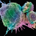 First allo T cell gets European nod