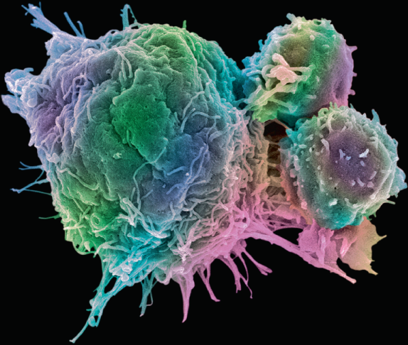 First allo T cell gets European nod