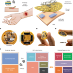 Wireless, closed-loop, smart bandage with integrated sensors and stimulators for advanced wound care and accelerated healing