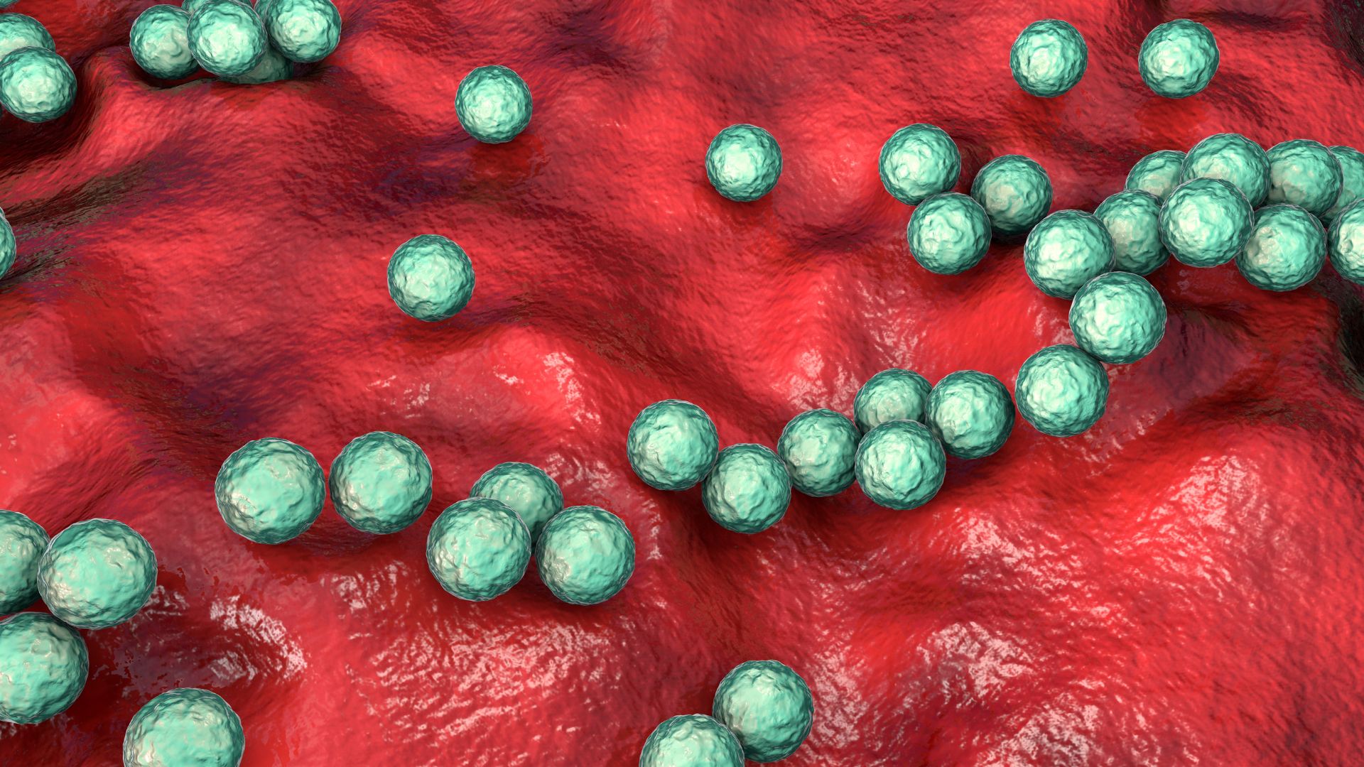 Dangerous strep infection surging in the UK may be spreading in US