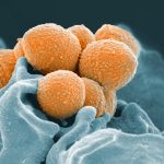 CDC issues warning about rise of invasive strep A infections in children