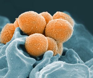 CDC issues warning about rise of invasive strep A infections in children