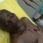 Man Stabbed At Winneba