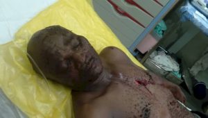 Man Stabbed At Winneba