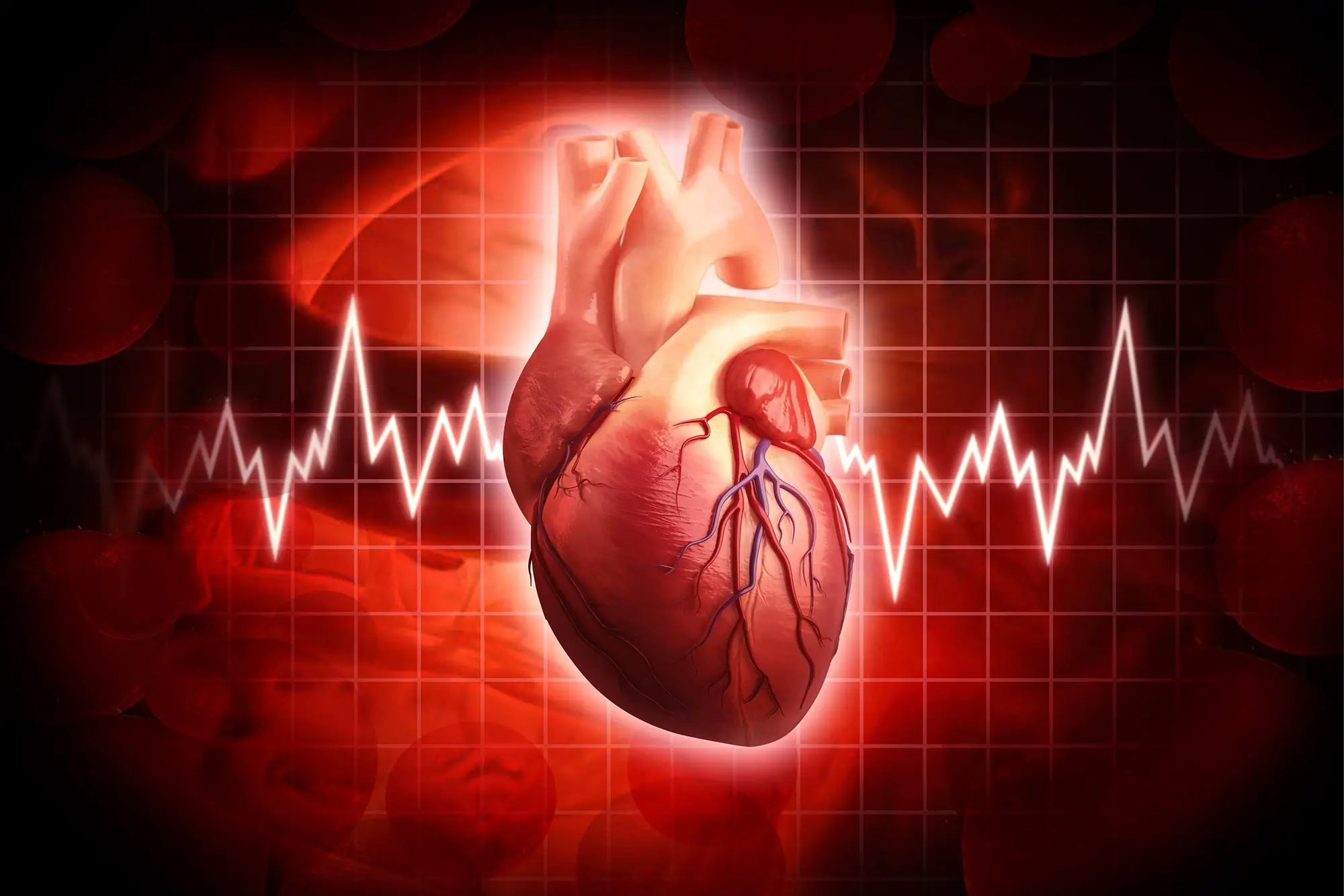 COVID Toll: Big Jump in Cardiovascular-Related Deaths Reported by American Heart Association