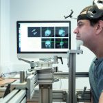 Brain stimulation might be more invasive than we think