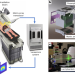 Real-time, volumetric imaging of radiation dose delivery deep into the liver during cancer treatment