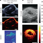 Real-time monitoring of tumor-homing bacteria and tumor cells in vivo using ultrasound