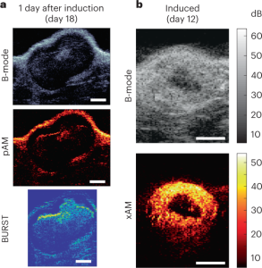 Real-time monitoring of tumor-homing bacteria and tumor cells in vivo using ultrasound