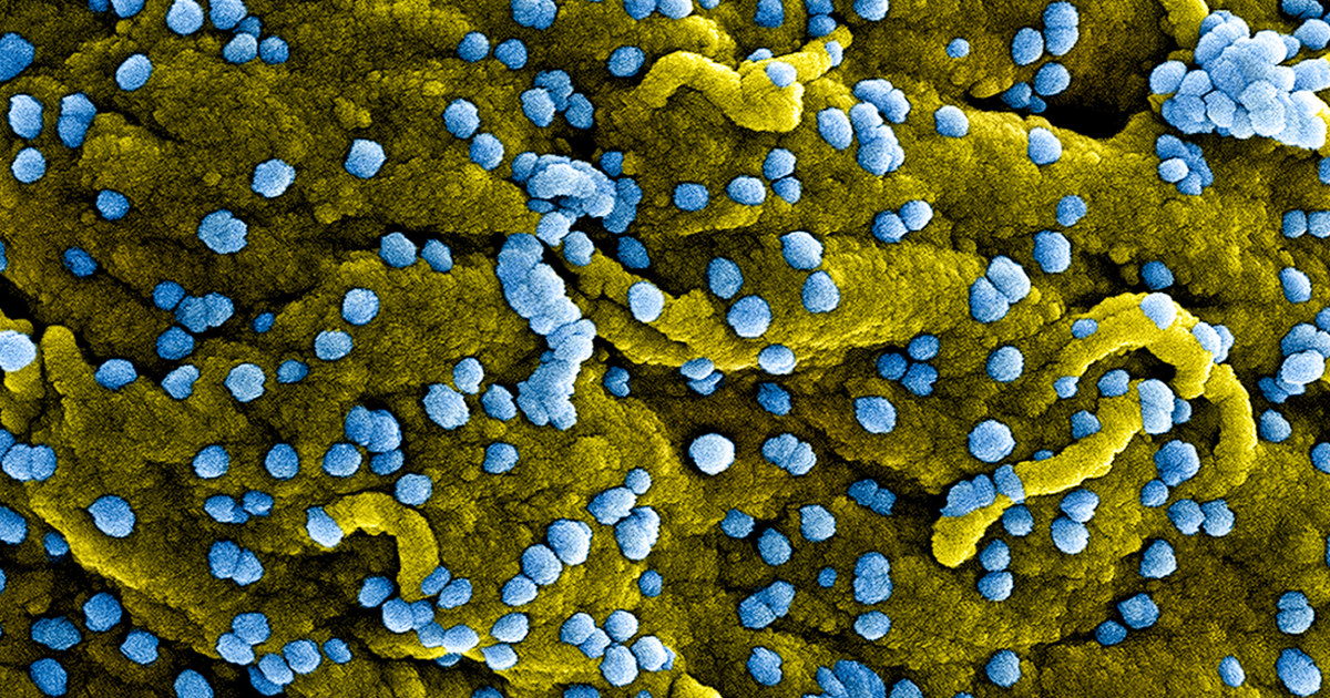 WHO hopes to test an experimental Marburg virus vaccine amid an outbreak in Equatorial Guinea