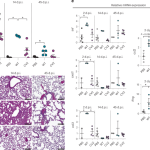 Engineered live bacteria suppress Pseudomonas aeruginosa infection in mouse lung and dissolve endotracheal-tube biofilms