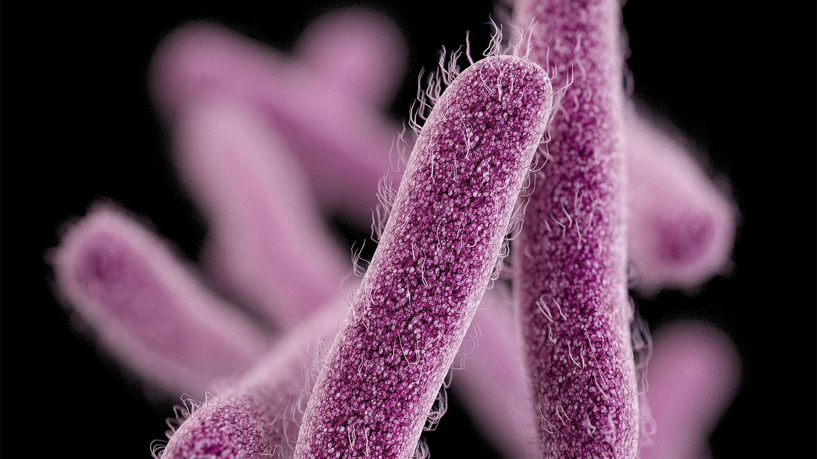 Extensively Drug-Resistant Shigellosis on the Rise in the U.S.