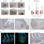 In vivo development of immune tissue in human intestinal organoids transplanted into humanized mice