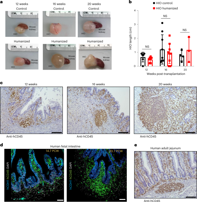 In vivo development of immune tissue in human intestinal organoids transplanted into humanized mice