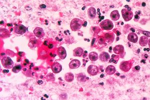 Man in Florida killed by rare, brain-eating amoeba Naegleria fowleri