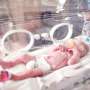 Preterm babies do not habituate to repeated pain, shows study