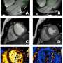 Imaging the adolescent heart provides ‘normal’ reference values for clinical practice