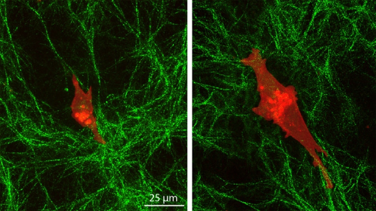 Cancer cells penetrate deeply into their environment