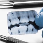 Millions expected to lose dental care coverage after Medicaid review