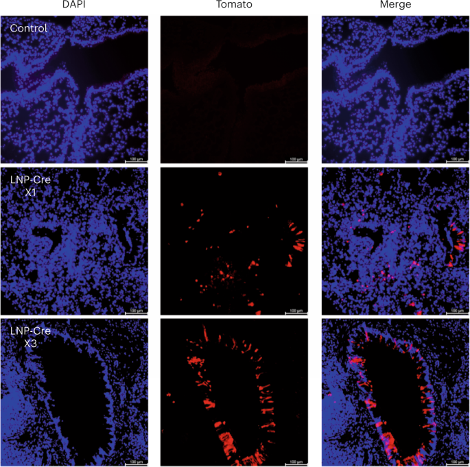 Lipid nanoparticle-enabled gene editing in the lung via inhalation