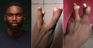 “Drop Your Account Number if You Fit Do Am”: Nigerian Man Starts Challenge on TikTok, Displays Twisted Fingers