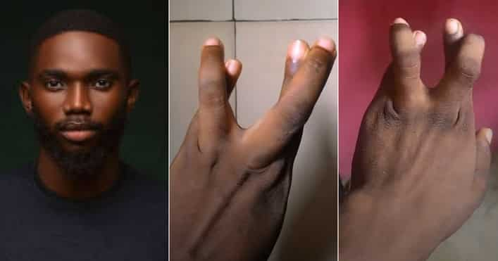 “Drop Your Account Number if You Fit Do Am”: Nigerian Man Starts Challenge on TikTok, Displays Twisted Fingers