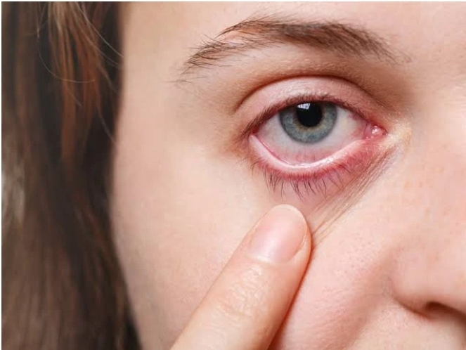 5 Vitamin A Rich Foods You Should Regularly Eat For Strong Eyes