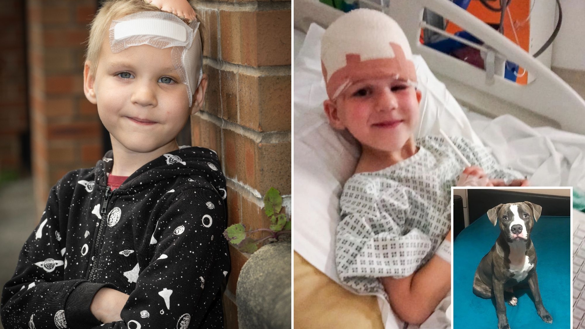 Dad issues warning after dog bought for £200 on Facebook scalps son, 6, in savage attack