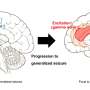 New study shows key role of synaptic plasticity in modulating brain function in patients with epilepsy