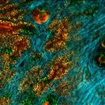 Skin cells work together to fight cancer