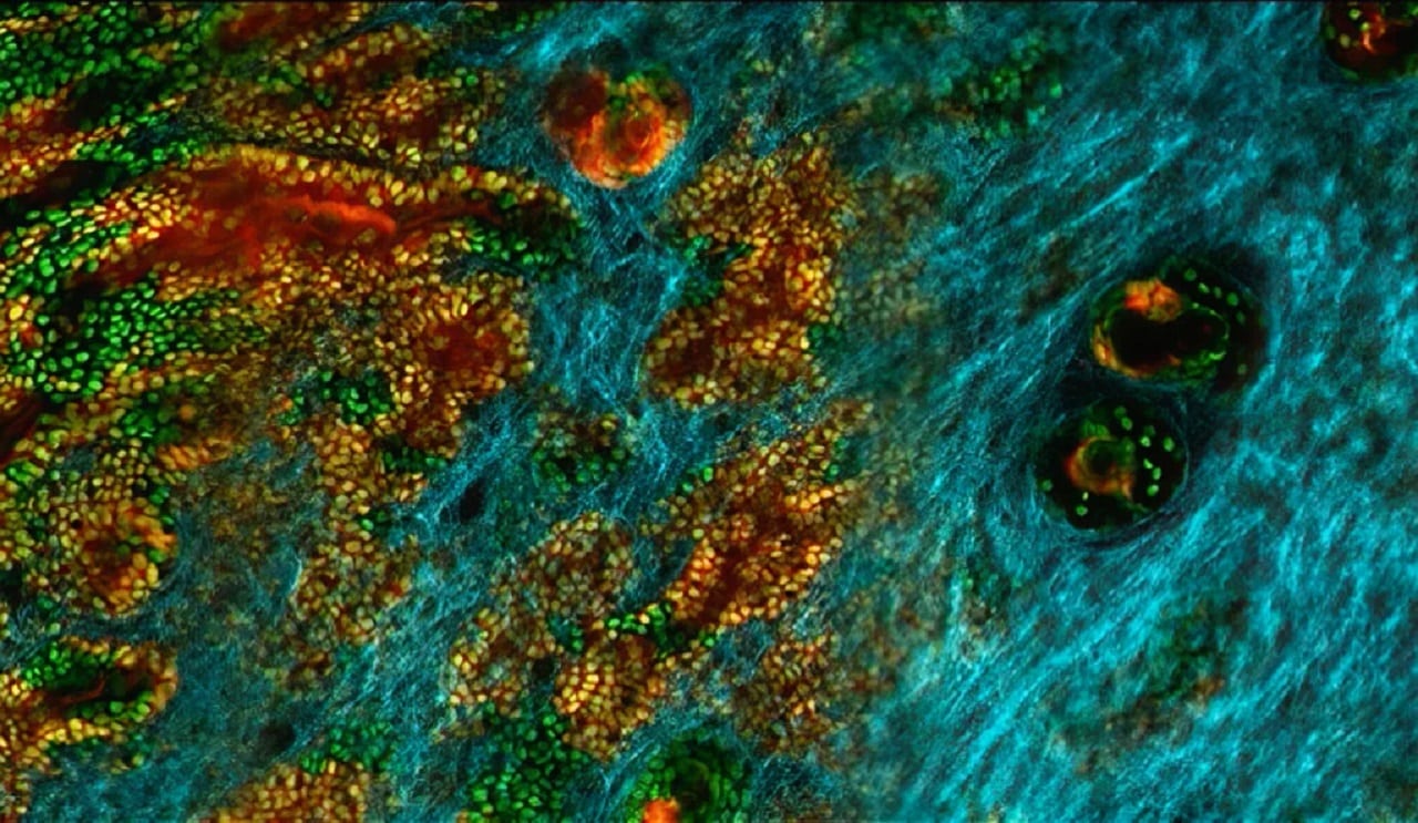 Skin cells work together to fight cancer