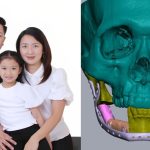 ‘Will my 6-year-old daughter recognise me?’ Dubai Filipino expat with facial tumour undergoes 3D-printed surgery