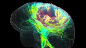 Stopping a tumor’s ‘cellular looting’ may help treatment for brain cancers