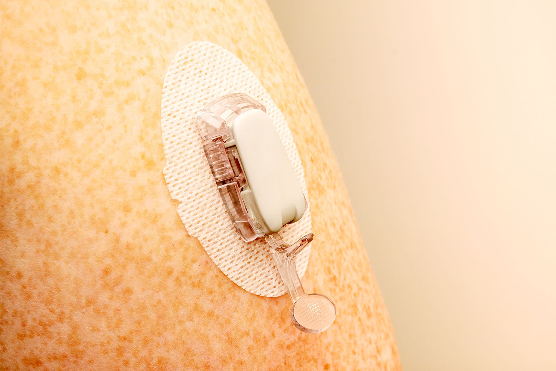 A Tiny Patch May Someday Measure Your Critical Health Needs