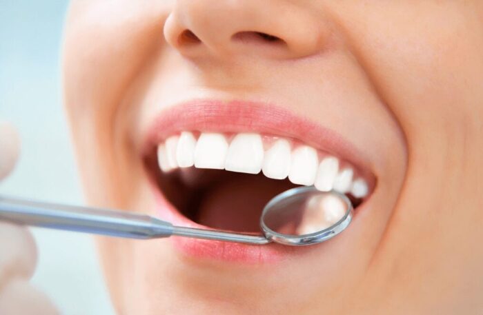 Secrets to Preserving Tooth Enamel: Avoid Erosion