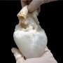 Lab-grown ‘ghost hearts’ combine a cleaned-out pig heart with a patient’s own stem cells