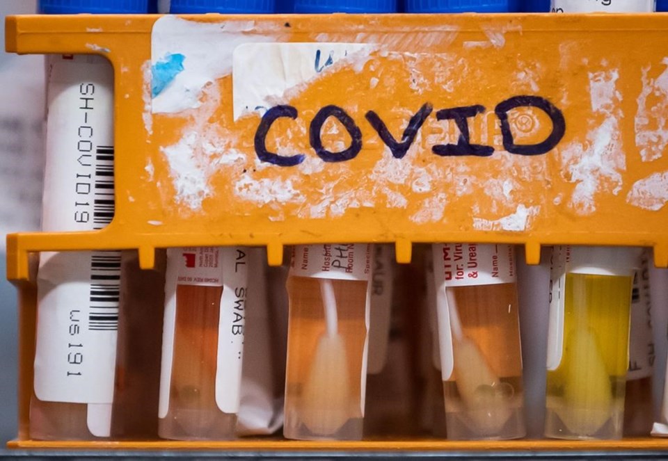 COVID-19 activity showing early signs that it may be increasing, new PHAC data says