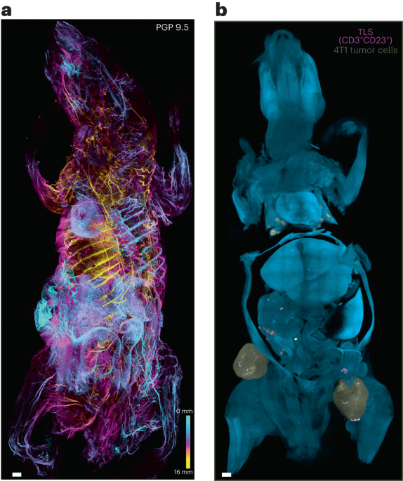 Breaking boundaries in whole-body imaging and disease understanding with wildDISCO