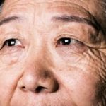 6 Eye Problems That Become More Common as We Age