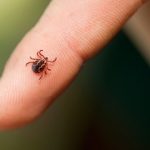 Human case of Lyme Disease reported by Sudbury health unit