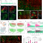 Young glial progenitor cells competitively replace aged and diseased human glia in the adult chimeric mouse brain