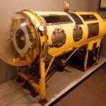 What Is an Iron Lung, and How Does It Work?