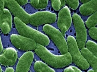 US health agency issues advisory for life-threatening, flesh-eating bacteria