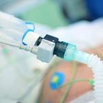 Low Tidal Volume Compliance Still Lacking in Mechanical Ventilation