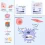 Possible markers identified for early metastatic lung cancer