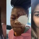 Man beats and destroys the eye of a beautiful lady for refusing to accept his proposal