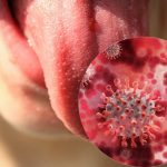 New Diagnostic System Based on Tongue Color Analysis Correctly Diagnoses Diseases in 94% of Cases