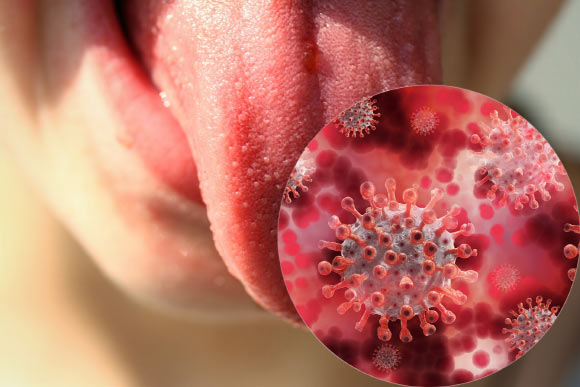 New Diagnostic System Based on Tongue Color Analysis Correctly Diagnoses Diseases in 94% of Cases