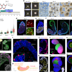 Self-organizing models of human trunk organogenesis recapitulate spinal cord and spine co-morphogenesis